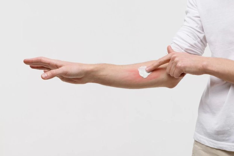 Cremă pentru râie la om. Cum poți scăpa de această afecțiune dermatologică