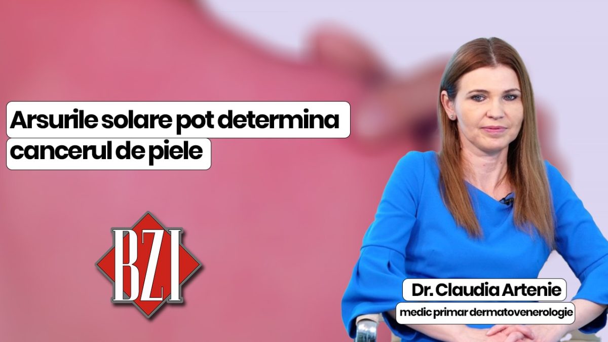 Dr. Claudia Artenie, medic primar dermatovenerologie discută în emisiunea BZI LIVE despre arsurile solare și urmările acestora