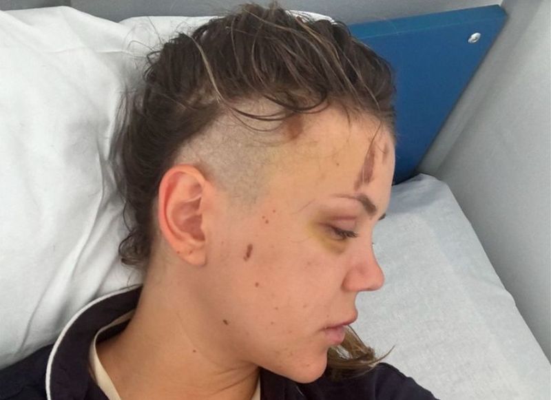 Emily Burghelea, rasă pe cap înainte de operație! „Moartea ne-a făcut cu mâna!“