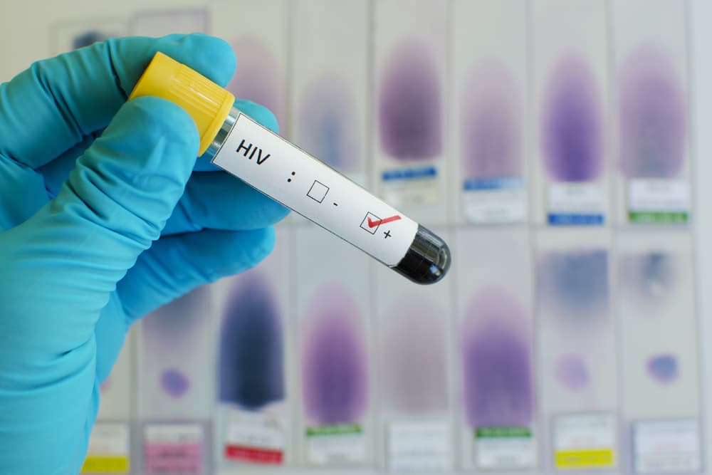 O injecție de două ori pe an ar putea oferi o protecție de 100% împotriva infecției cu HIV la femei