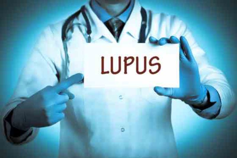 Alimente interzise în lupus. Care este alimentația de care trebuie să ții cont