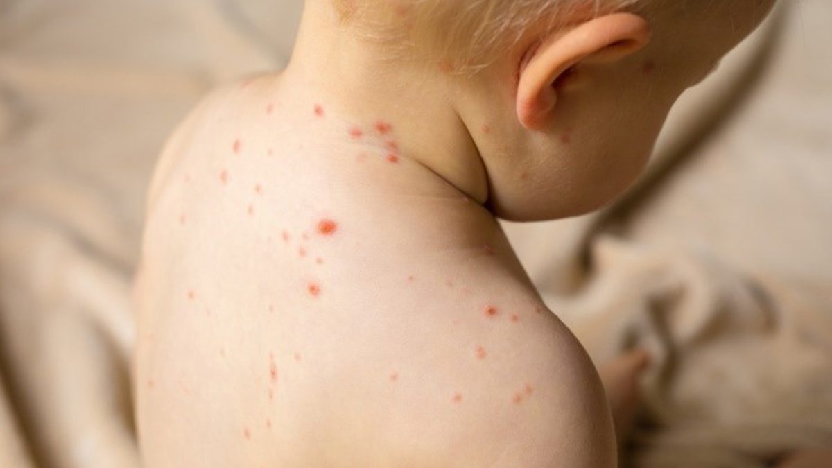 Un bebeluș de doar 8 luni, din Iași, a murit din cauza rujeolei! Băiețelul s-a infectat de la mama și fratele său