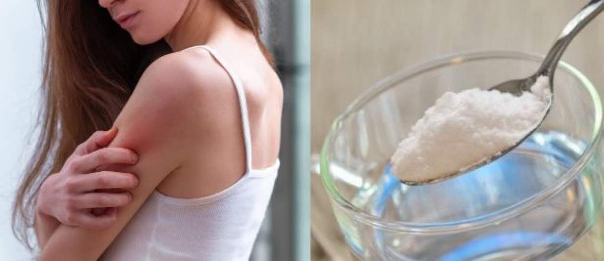 Bicarbonat de sodiu pentru alergii, remediul natural pentru simptomele alergiilor de primăvară