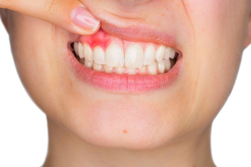 De ce apare infecția dentară? Bicarbonat de sodiu pentru ameliorarea durerii