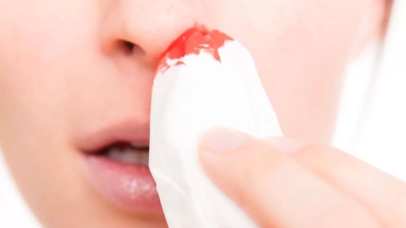 Sânge din nas de la cancer? Când ar trebui să ne facem griji