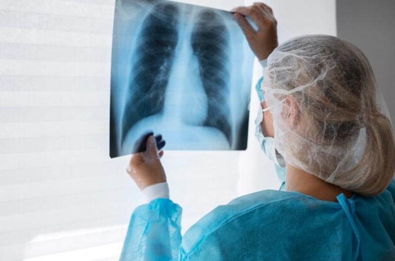 Ce este boala plămânului alb? Nu este un virus, ci o bacterie atipică!