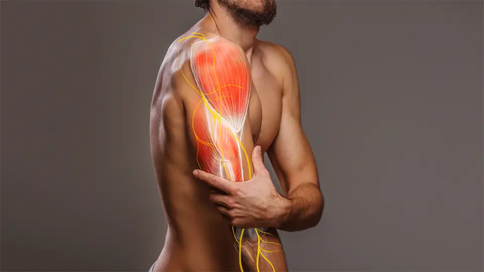 Cât durează o întindere musculară? Ce simptome sunt și cum să o previi