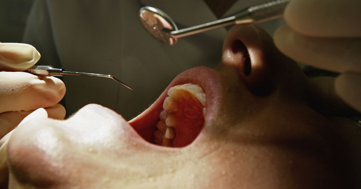 Plombele dentare vor fi interzise de la 1 ianuarie 2025! Iată care este motivul