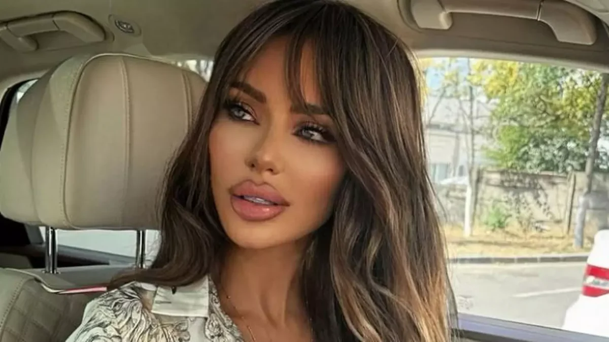 Câte intervenții estetice are Bianca Drăgușanu și pe care le regretă cel mai mult. „Sprâncenele mele au o culoare de verde-albăstrui, mov, gălbui, curcubeu”