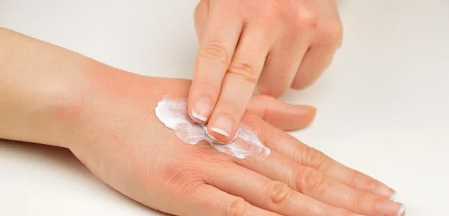 De ce se exfoliază pielea de pe palme? Ce remedii naturiste există?