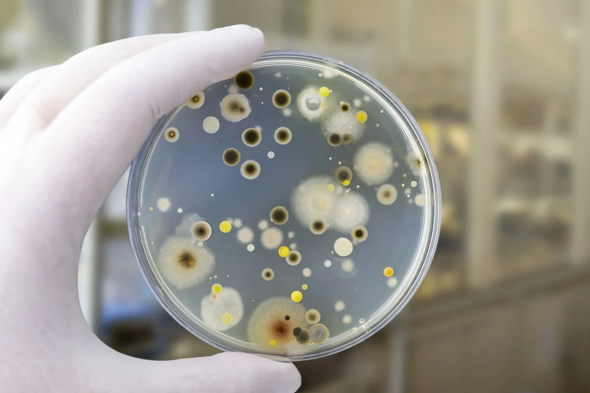 Crește numărul îmbolnăvirilor provocate de bacteriile din alimente