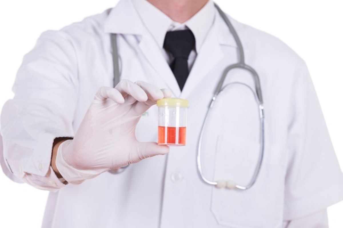 Cauzele comune pentru urina cu sânge la femei. Ce boli ascunde această problemă medicală?