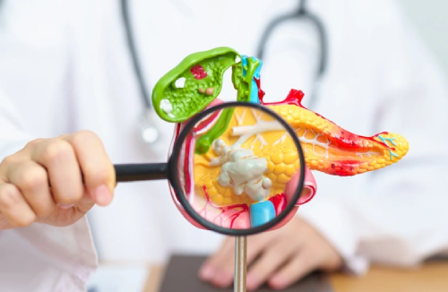 Cât poți trăi cu pancreatită? Organul care dă semne de boală doar când este prea târziu!