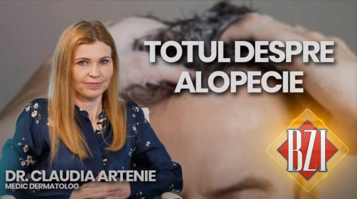 Dr. Claudia Artenie, medic primar dermatovenerologie – Pro Life Clinics, discută în emisiunea BZI LIVE despre tipurile, cauzele și tratamentele alopeciei