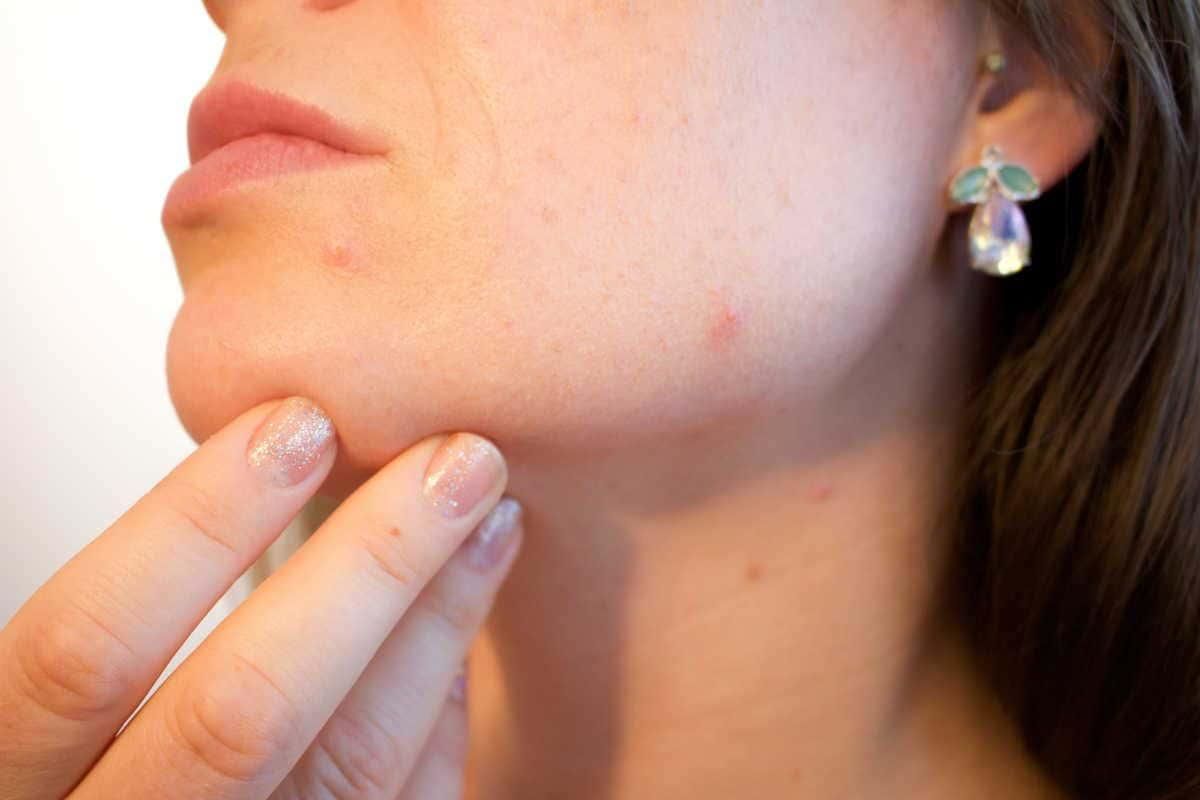 Poți face baie când ai varicelă? Sfaturi de care să ții cont