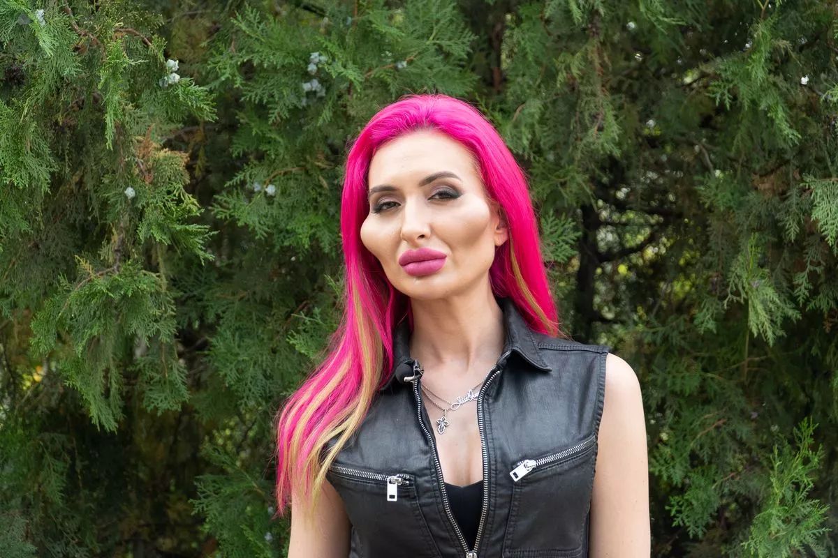 Anastasia este femeia cu cei mai mari obraji din lume! „Erai atât de frumoasă”