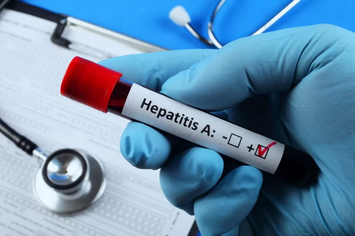 Focar de hepatita A la un liceu din România! Nouă cazuri au fost deja confirmate