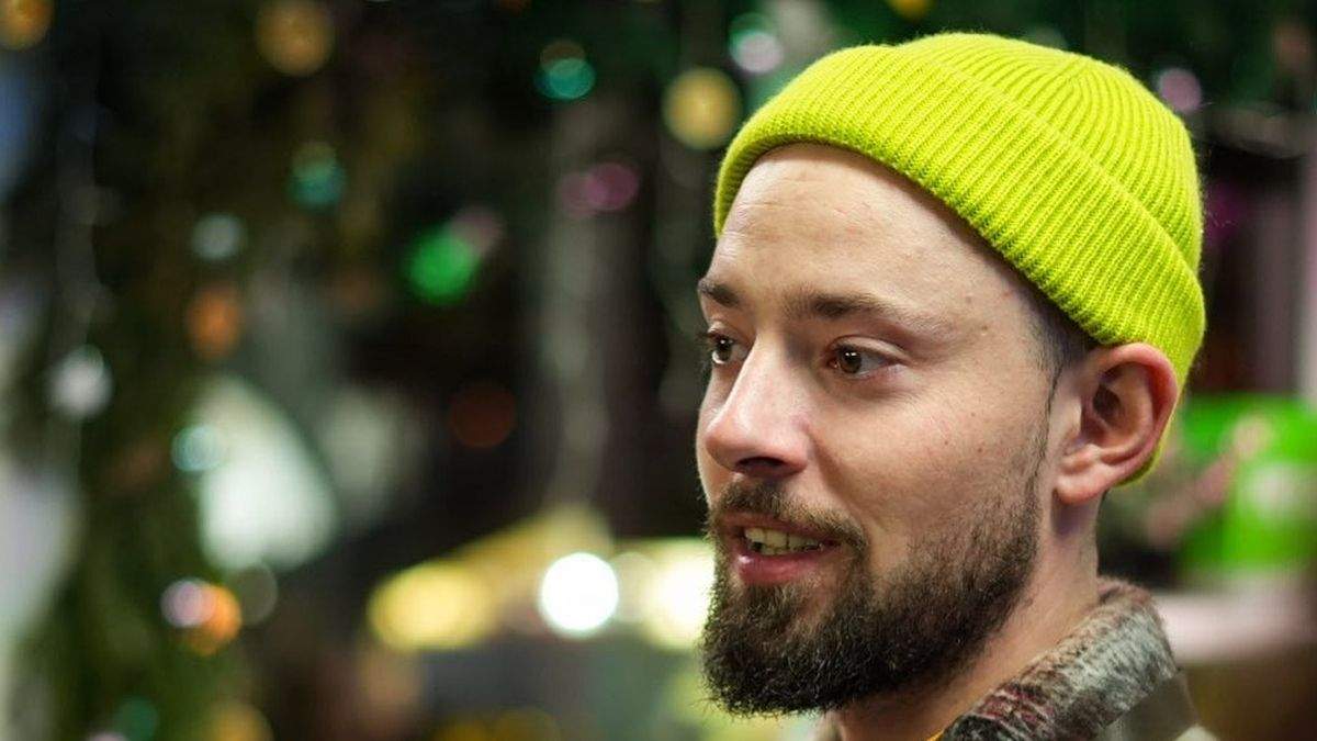 Artistul care și-a făcut implant de păr! După patru ani de amânări, acesta a făcut pasul