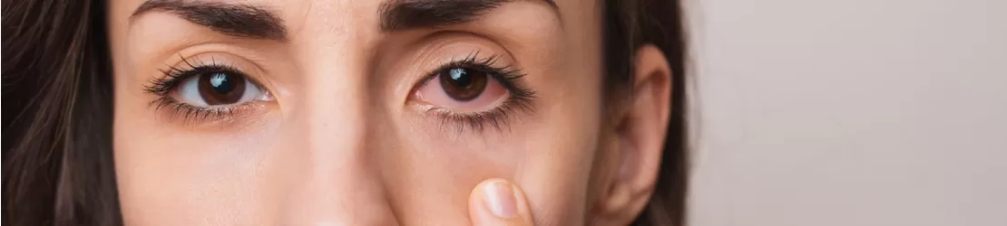 Sindrom Sjogren. Tot ce trebuie să știi despre această afecțiune autoimună