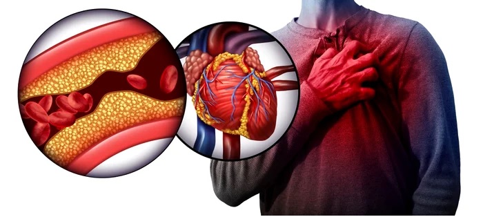 Ce să mănânci pentru scăderea colesterolului fără medicamente. Află ce probleme de sănătate poate provoca hipercolesterolemia!