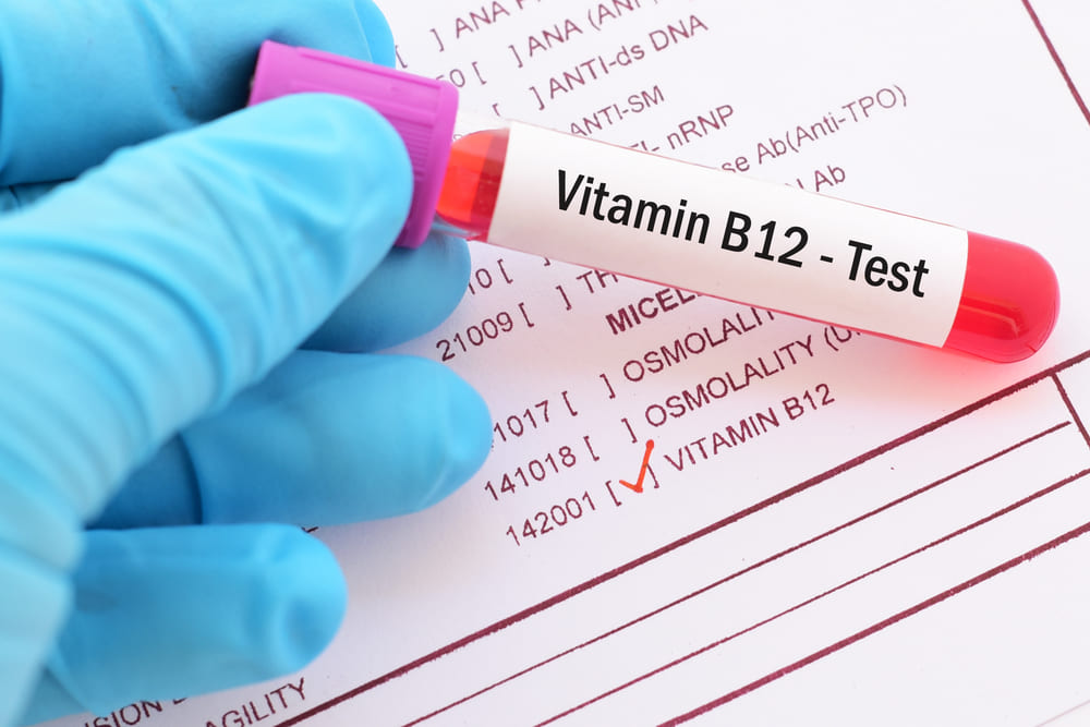 Ce boli ascunde o valoare crescută a vitaminei B12 și care sunt cauzele. Află dacă are un efect negativ asupra sănătății