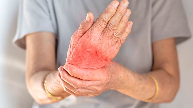 Poliartrita reumatoidă este cancer? Află dacă este sau nu ereditară!