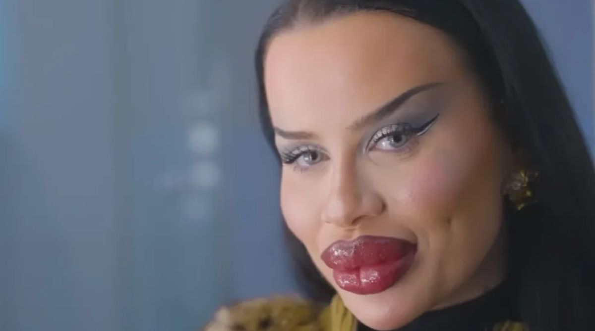 E dependentă de botox! „Prietenii spun că îmi voi distruge fața, dar eu ador aspectul fals!”