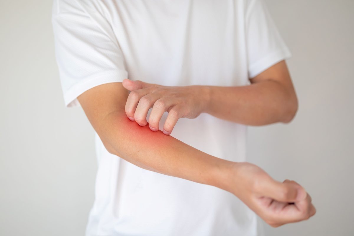 Cum să tratezi dermatita atopică la copii. Care sunt cauzele ce stau la baza erupției cutanate