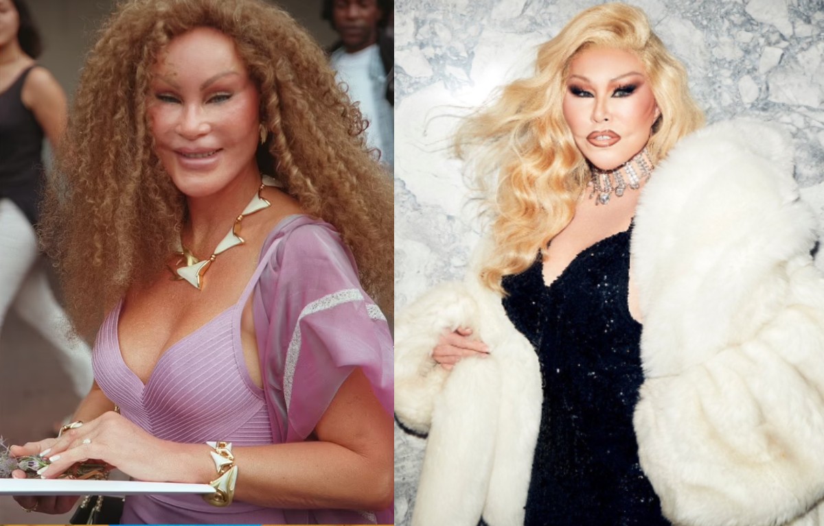 Jocelyn Wildenstein, supranumită „Catwoman”, s-a stins din viață la 84 de ani