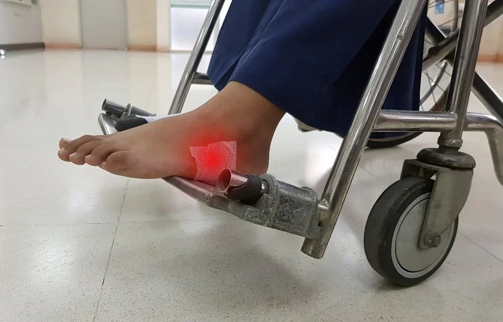 Necroza, cauze, simptome și părțile corpului pe care le poate afecta