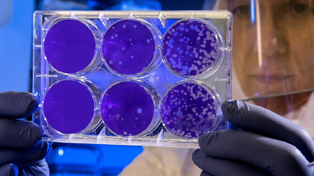 Alertă sanitară în Congo: Zeci de morți și sute de cazuri într-o epidemie misterioasă