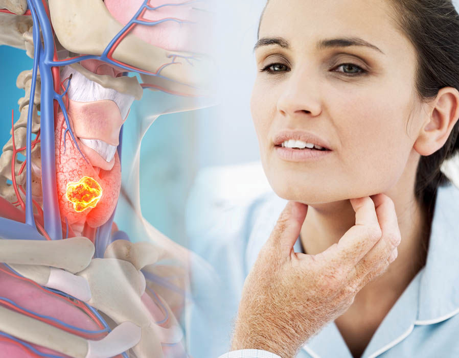 Care sunt primele simptome ale cancerului de gât? Află de ce este importantă diagnosticarea precoce