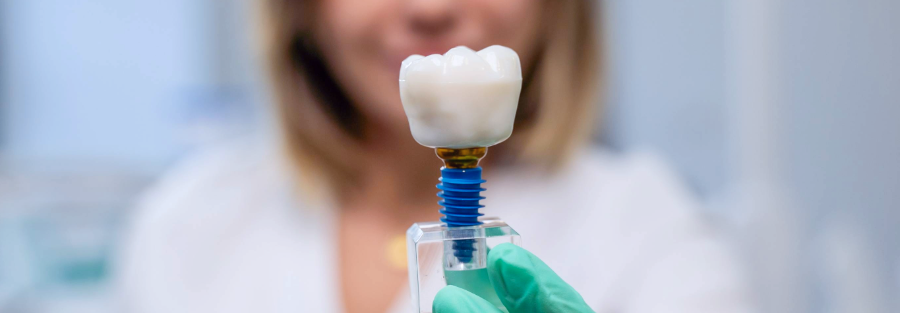 Care sunt simptomele respingerii unui implant dentar? Iată ce este de făcut