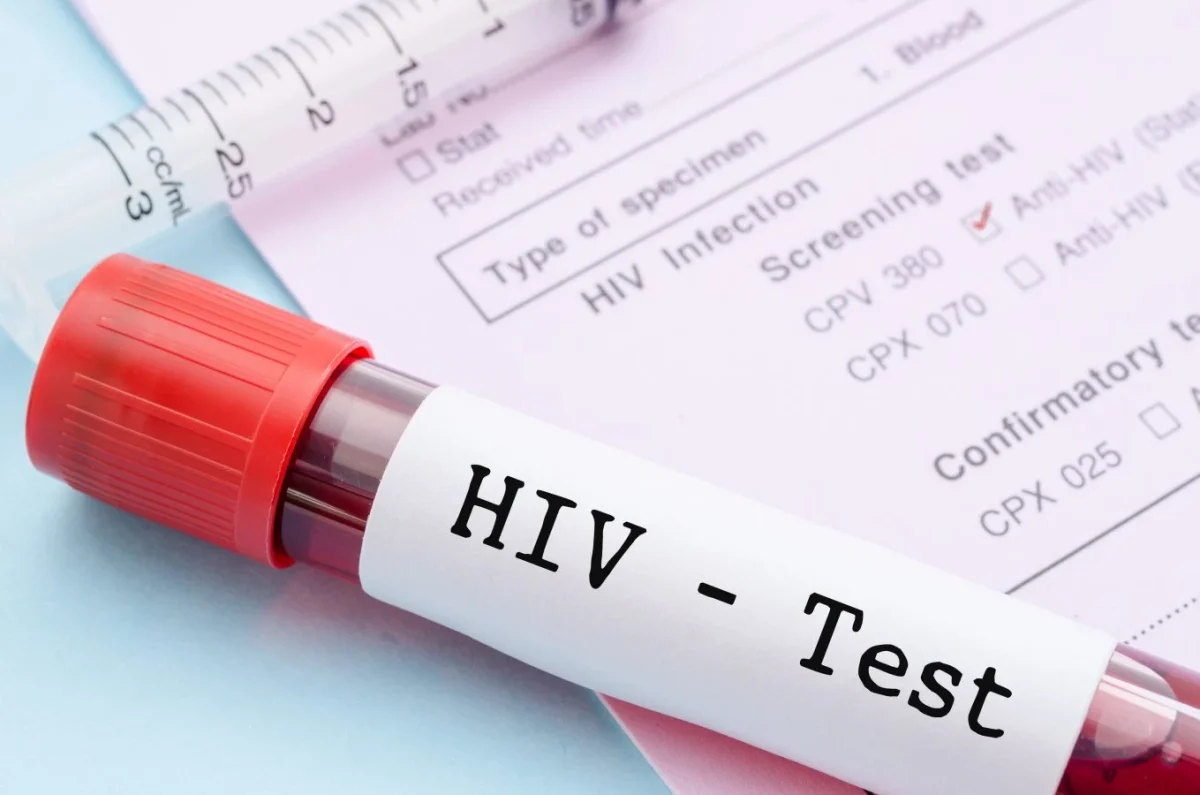 Numărul persoanelor infectate cu HIV ar putea să crească cu 2.000 de cazuri în fiecare zi, din cauza sistării sprijinului oferit de SUA
