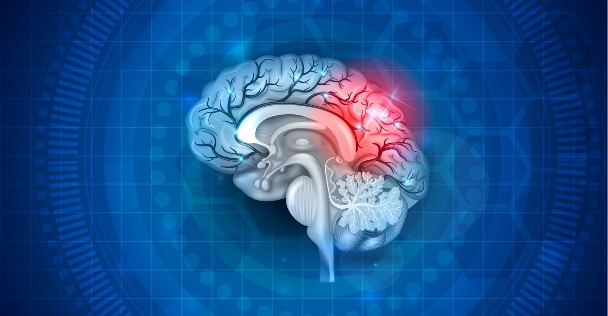 Ce este hematomul subdural? Cauze, simptome și tratament