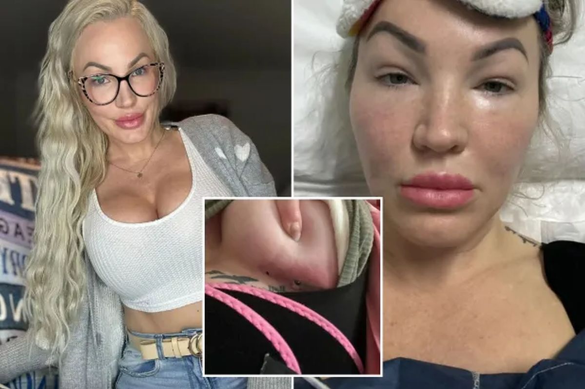 A vrut să-și îmbunătățească părțile intime sub bisturiu și a rămas traumatizată! „M-au lăsat cu răni deschise timp de o oră!”