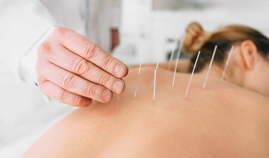 De ce este periculoasă acupunctura? Află cât de sigură este, de fapt, medicina alternativă!