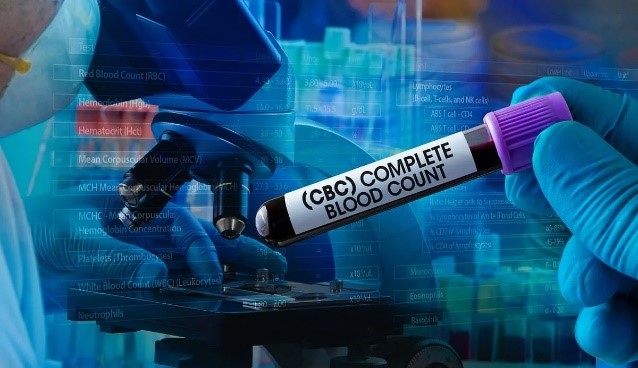 Hemoleucogramă completă preț. Află de ce este importantă și când trebuie făcută