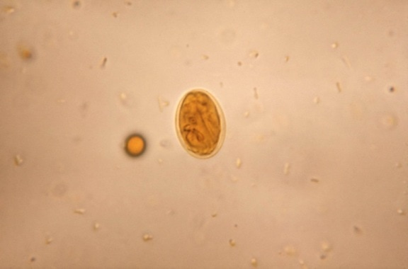 Laboratoarele Praxis : Giardia intestinalis – un parazit invizibil care îți poate afecta sănătatea. Cum se poate  depista corect?