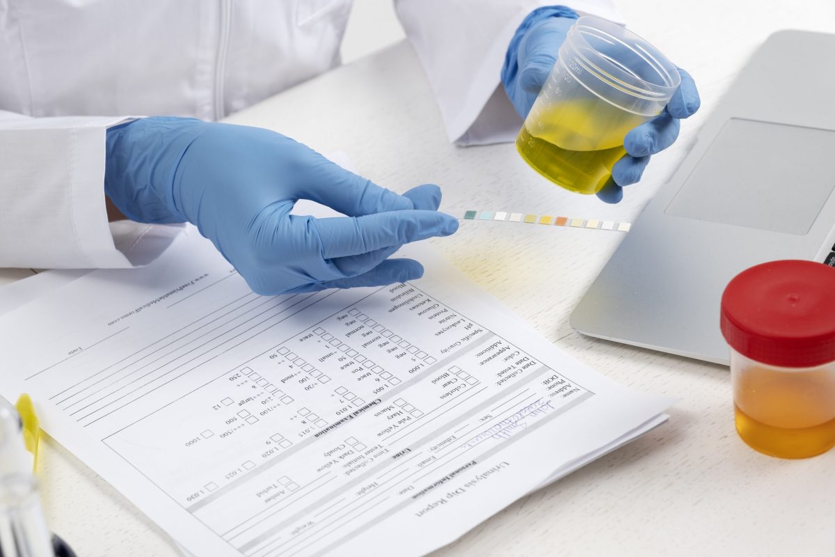 Cât de eficiente sunt testele pentru infecțiile urinare? Sunt o boală frecventă a aparatului urinar!
