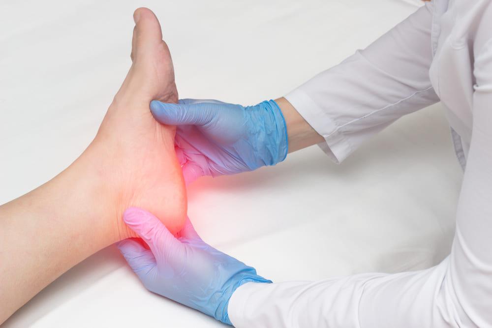 Cremă pentru fasceita plantară – Cum acționează și ce trebuie să conțină?
