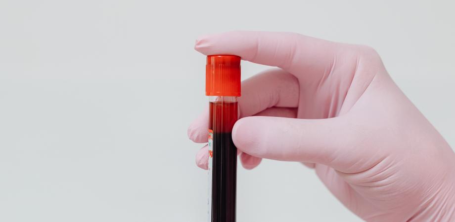 Ce simptome apar atunci când ai leucocite mari? Infecție sezonieră sau afecțiune cronică?