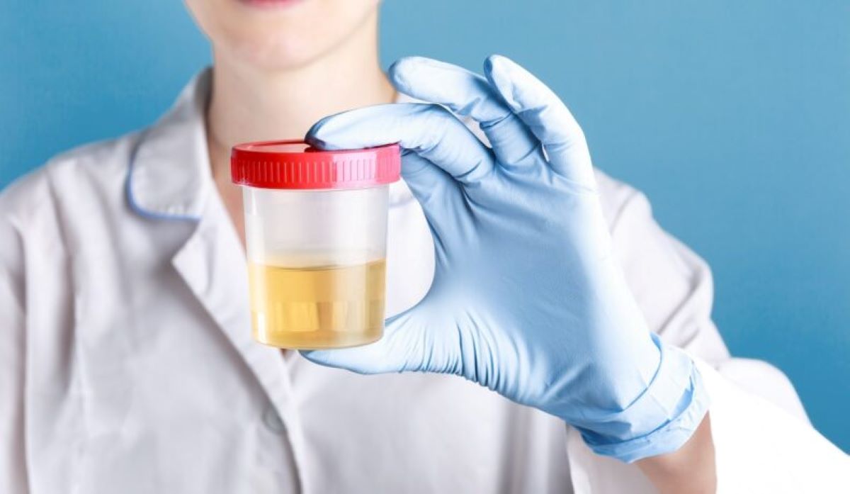 Ce afli dintr-un sumar de urină și urocultură și care este prețul, de fapt? Două analize care pot preveni complicații grave!