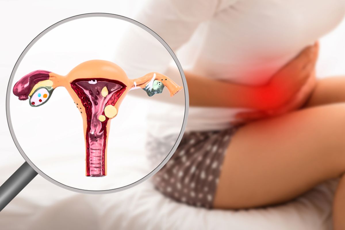 Endometru îngroșat, ce trebuie să știm? Află când ar trebui mers la medic!