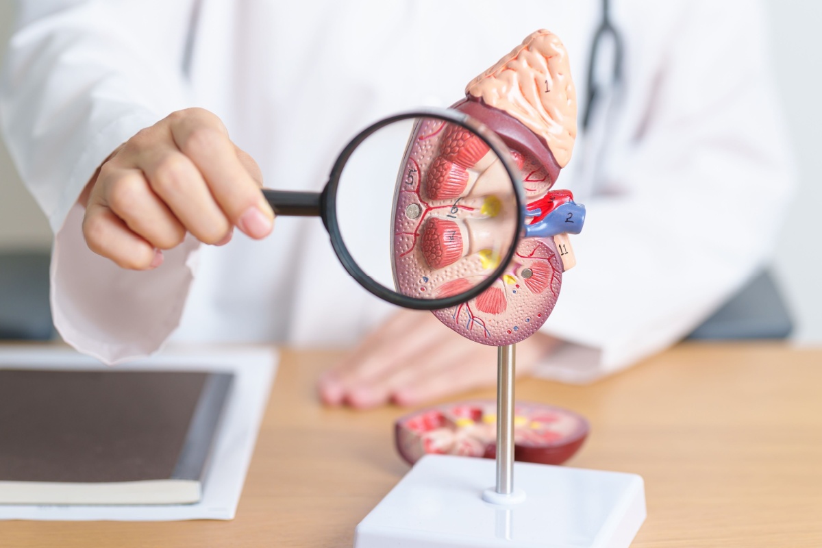 Pielonefrita acută, o afecțiune renală severă ce trebuie recunoscută și tratată prompt pentru a preveni complicațiile