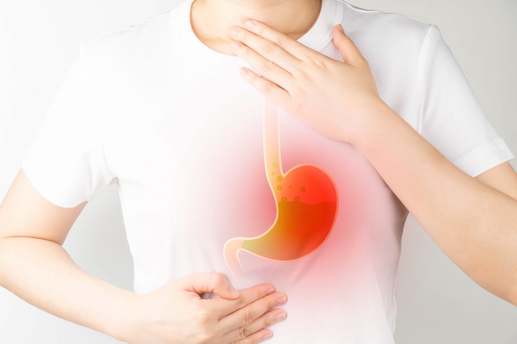 Schemă completă de tratament pentru refluxul gastroesofagian – Iată tot ce trebuie să știi pentru a aborda eficient această afecțiune