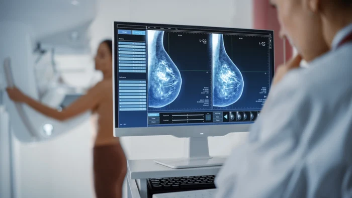 Descoperire revoluționară împotriva cancerului de sân! Un nou medicament reduce la jumătate riscul de progresie sau deces