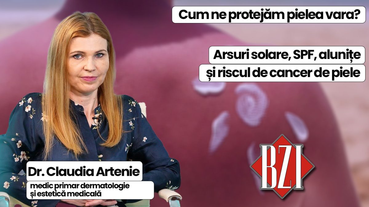LIVE VIDEO – Sănătatea pielii vara, arsuri solare, alunițe periculoase și protecția corectă cu SPF, subiectul emisiunii de sănătate BZI LIVE, împreună cu invitata dr. Claudia Artenie, medic primar dermatologie și estetică medicală