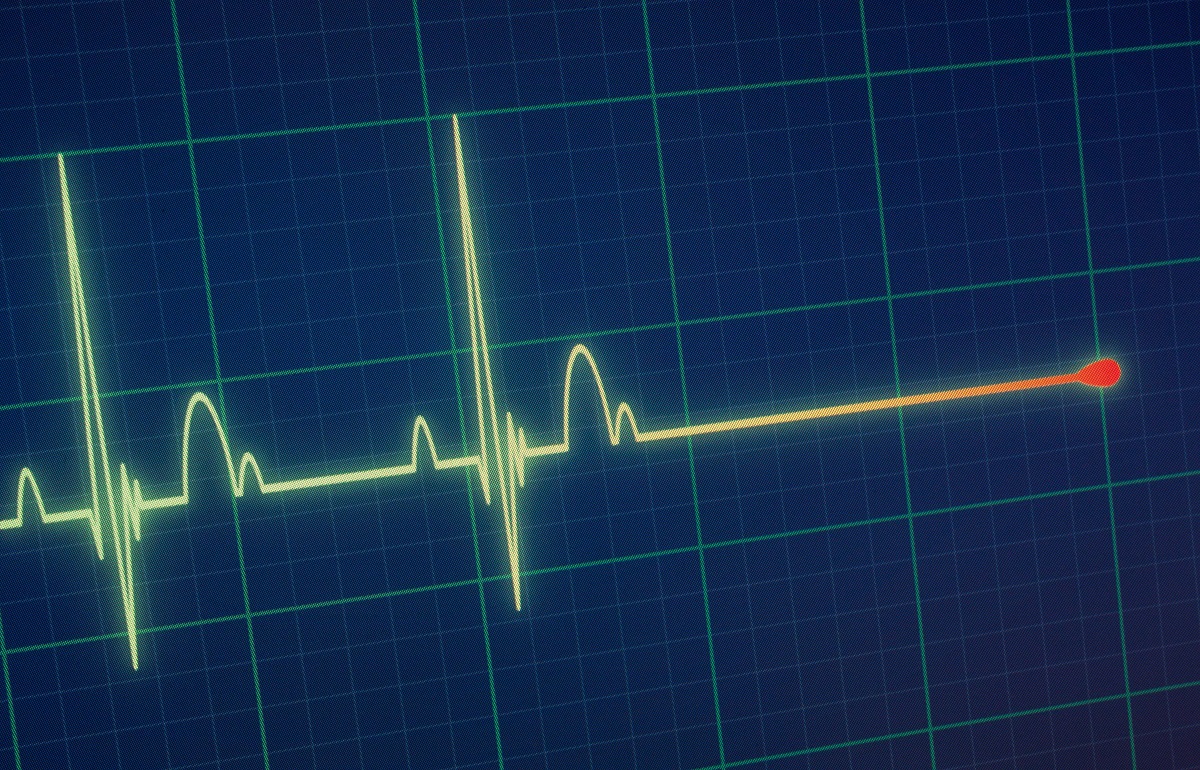 „Fenomenul Lazăr” zguduie lumea medicală! Un bărbat declarat mort s-a trezit după 30 de minute