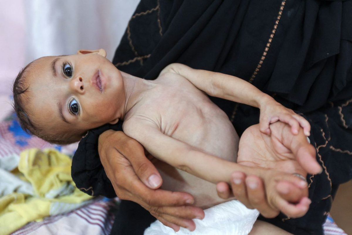 Locuitorii din Gaza mor de foame! Sunt „cadavre ambulante” pe măsură ce cazurile de malnutriție cresc, spune șeful UNRWA